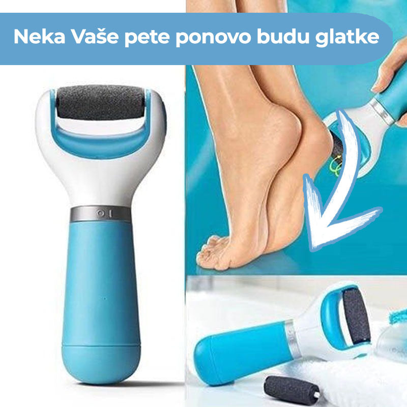 Električna turpija za pete na baterije — pregled