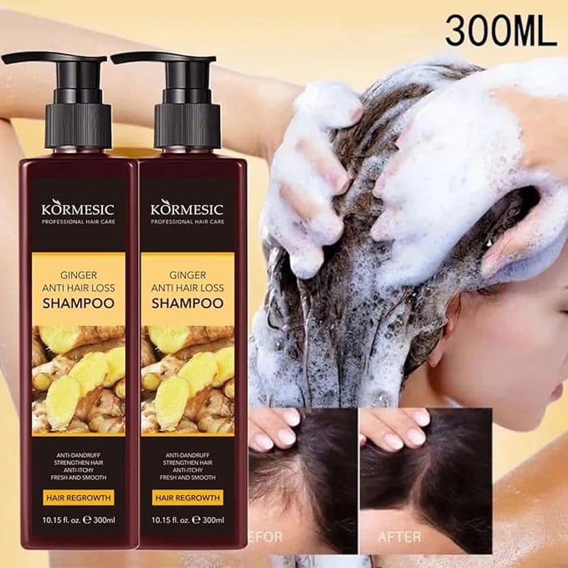 šampon sa đumbirom protiv opadanja kose i peruti, dve boce od 300ml