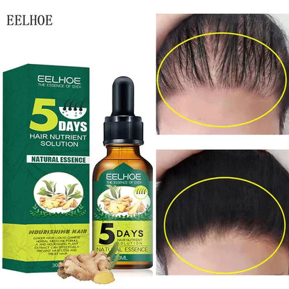 serum protiv opadanja kose sa đumbirom — detalj 2