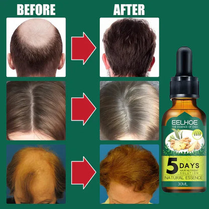 serum protiv opadanja kose sa đumbirom — detalj 3