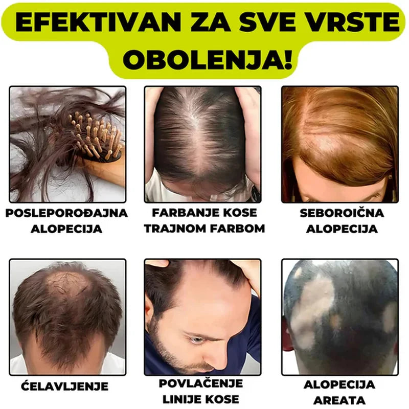serum protiv opadanja kose sa đumbirom — detalj 4